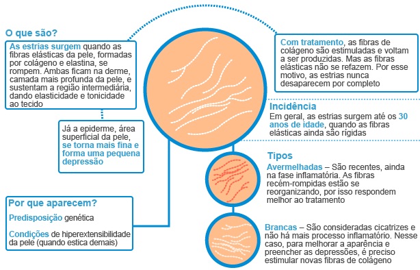 Creme tratamento para estrias